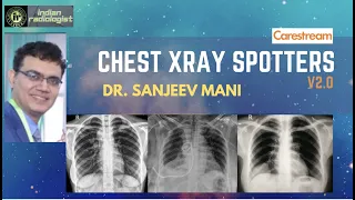 XRAY CHEST SPOTTERS  - V2.0 || DR SANJEEV MANI || EXAM CASES ||