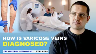 Diagnosis of Varicose veins | Varicose veins diagnosis | Doppler ultrasound | Dr. Gaurav Gangwani