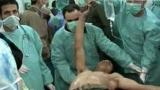 Syria state TV purports to show victims of 'chemical attack'