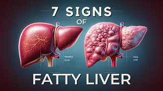 7 Early Warning Signs of Fatty Liver Disease Revealed