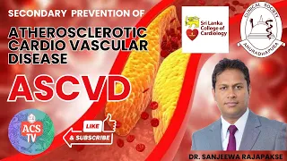 Secondary Prevention of Atherosclerotic Cardio Vascular Disease by. Sanjeewa Rajapakse