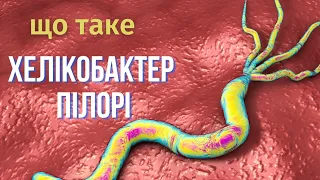 Що таке хелікобактер пілорі? Як діагностувати хелікобактер? | гастроентеролог Юрій Душинський