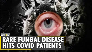 Black Fungus infections on the rise in India | Coronavirus Updates | Latest World English News