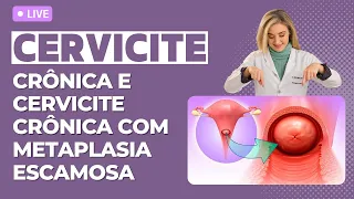 Cervicite crônica e cervicite crônica com metaplasia escamosa