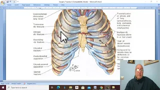 Trauma in Arabic 20 ( Chest Injuries  in general ) , by Dr. Wahdan .