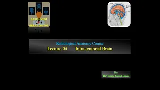 Radiological Anatomy Course -Lecture 05 -Brain Infra-tentorial Part(4)