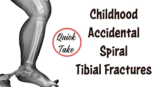 Toddler's Fractures and C.A.S.T. Fractures Quick Take