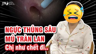 NẠN NHÂN bị BỎ QUÊN gạc trong ngực KỂ 40 ngày TỬ THẦN