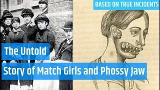 The Untold Story Of Match Girls | True Story | Phossy Jaw | Enola Holmes 2