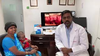 Pierre Robin Sequence or syndrome kid with cleft palate repair @ Richardsons Craniofacial Hospital