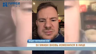 Избитый пермским экс-депутатом Dj Smash показал обезображенное лицо