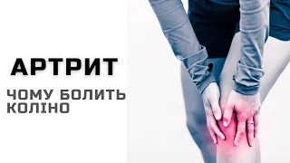 Артрит. Причини болі в колінному суглобі | ортопед-травматолог Віктор Костюк | Ранок надії