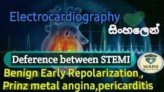 Deference(ECG pattern)between STEMI; Pericarditis/Prinze metal Angina/Benign  Early  repolarization