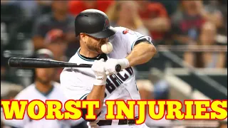 MLB | Worst Injuries Compilation in the MLB