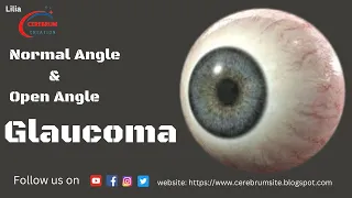 Development of Glaucoma Animation, Open Angle vs Angle Closure Glaucoma | #glaucoma #eyetreatment