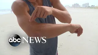 Surfer's shark bite caught on camera off Florida coast