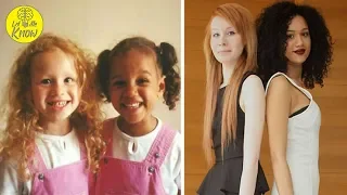 Mom’s twins born with different skin color – 18 years later, they look completely different
