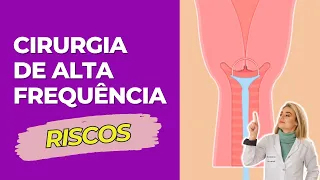 Quais os riscos da cirurgia de alta frequência (CAF)?