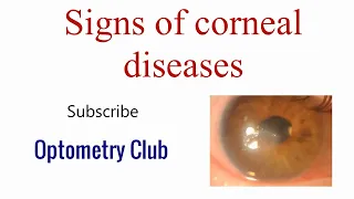 Signs of Superficial Corneal Diseases