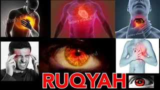 Ruqyah Shariah for remove evil eye , remove sihir  - Beautiful & Peaceful -Helmy Elsayed
