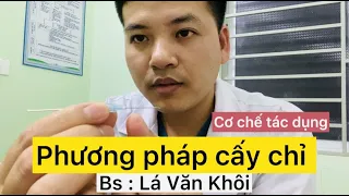 Phương pháp cấy chỉ trong Đông y và cơ chế tác dụng | Bác sĩ Lá Văn Khôi