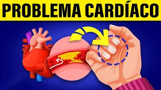 Os 5 principais sintomas de doenças cardíacas que suas mãos revelam