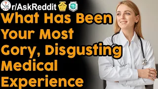 What has been your most gory, disgusting or worst medical experience? (r/AskReddit | Reddit Stories)