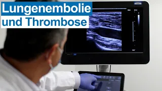 Thrombose und Lungenembolie: UKM-Experte über Ursachen, Risiko-Faktoren und Tipps für Prävention