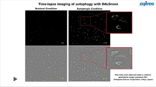 Time-lapse imaging of autophagy [DALGreen- Autophagy Detection :Dojindo]