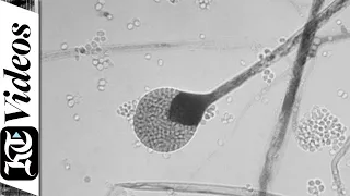 Mucormycosis: The black fungus hitting Covid-19 patients