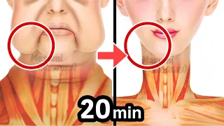 20mins🔥Anti-Aging Face Lift Exercise for Jowls, Laugh Lines, Slim Jawline!