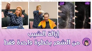 القضاء على الشعر الأبيض نهائياً من الجذور