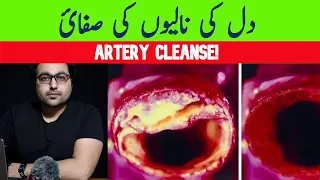 Dr. Zee:The BEST Meal to Clean Out Your Arteries