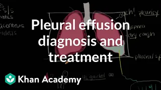 Pleural effusion diagnosis and treatment | Respiratory system diseases | NCLEX-RN | Khan Academy