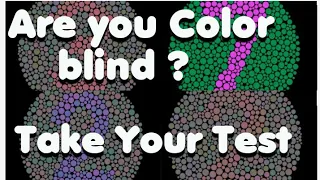 Do You Have Color blindness?|Are you Color blind?|Color blind test| Ishihara Color blindness test|