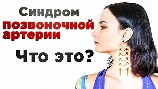 Как вылечить синдром позвоночной артерии?