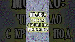 Молоко кровь под микроскопом