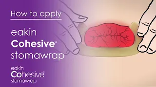 How to apply Cohesive StomaWrap™