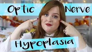 What is Optic Nerve Hypoplasia?: Why I’m Registered Blind | Fashioneyesta