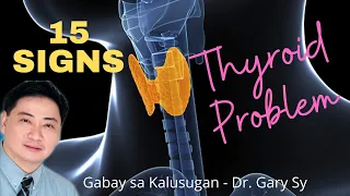 15 Signs of Thyroid Problem - Dr. Gary Sy