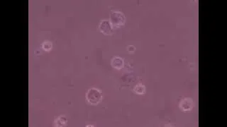Time-Lapse of MDA-MB-231 Breast Cancer Cells After Trypsinization