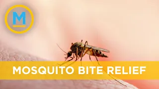 Home remedies to help with itchy mosquito bites | Your Morning
