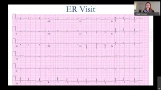 JACC: CardioOncology Virtual Case Presentation Series: Amyloidosis | Part Two