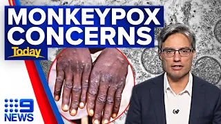 Monkeypox outbreak: How concerned should we be? | 9 News Australia