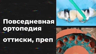 ПОВСЕДНЕВНАЯ ОРТОПЕДИЯ ПРЕП, ОТТИСКИИ ТД