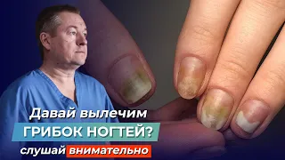 ШОКИРУЮЩАЯ ПРАВДА ПРО ГРИБОК НОГТЕЙ! Как вылечить ОНИХОМИКОЗ самостоятельно?