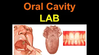 Oral Cavity LAB