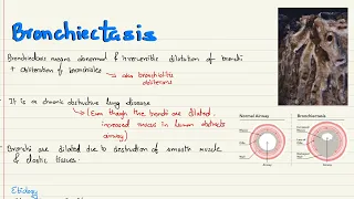 Bronchiectasis: Causes, Features, Investigations, Treatment and Complications