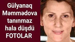 Xalq artisti Gülyanaq Məmmədova tanınmaz halda - FOTOLAR