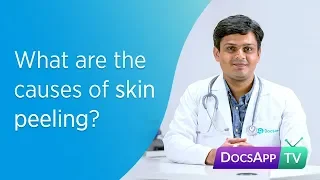 What are the causes of Skin Peeling? #AsktheDoctor